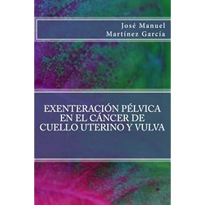 Exenteracion pelvica en el cancer de cuello uterino y vulva (Spanish Edition)