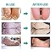 Foot Peel Mask Feet Baby Soft Touch 2 Pack- Phenitech Exfoliating Dead skin Foot Peeling Mask and Callus Reducer Away