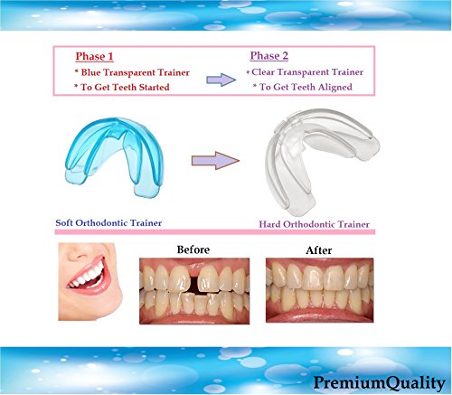 Orthodontic teeth trainer kit adult teeth straightener …