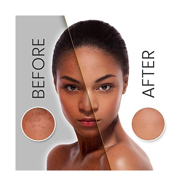 Caris White Radiance Pure Skin Whitening Milk 177ml - Lightening Brightening Bleaching Fairness Body Lotion - For uneven…