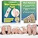 Wart Remover, Corn Remover Pads, Foot Corn Removal Plaster with Hole, Professional Removes Common and Plantar Warts, Callus, Stops Wart Regrowth 24Pcs