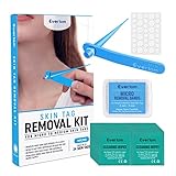 Micro Skin Tag Remover - Painless Skin Tag Removal