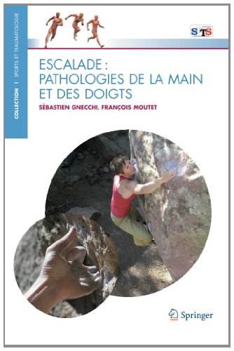 Escalade