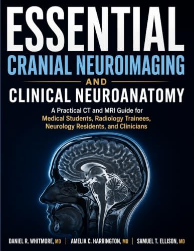 Functional MRI: An Introduction to Methods: 9780198527732