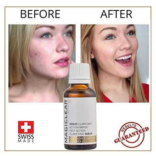 best anti aging spot remover