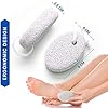 NIMXY-Pumice-Stone-for-Feet-and-Hands-2-Pcs--Feet-Hard-Skin-Remover--Foot-Scrubber-for-Dead-Skin-Removal--Natural-Foot-File-and-Callus-Remover-for-Skin-Exfoliation NIMXY Pumice Stone for Feet and Hands 2 Pcs – Feet Hard Skin Remover – Foot Scrubber for Dead Skin Removal – Natural…
