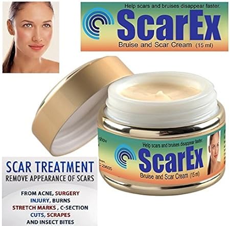 acne and dark spot remover cream