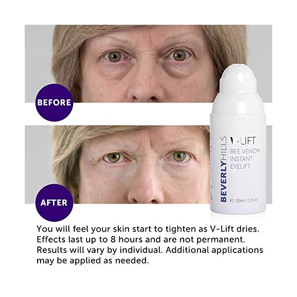 Beverly-Hills-V-Lift-Instant-Eye-Lift-and-Eye-Tuck-Bee-Venom-Serum-for-Treating-Puffy-Eyes-Dark-Circles-and-Wrinkles BEVERLY HILLS V-Lift Instant Eye Lift and Eye Tuck Bee Venom Serum for Treating Puffy Eyes, Dark Circles, and Wrinkles