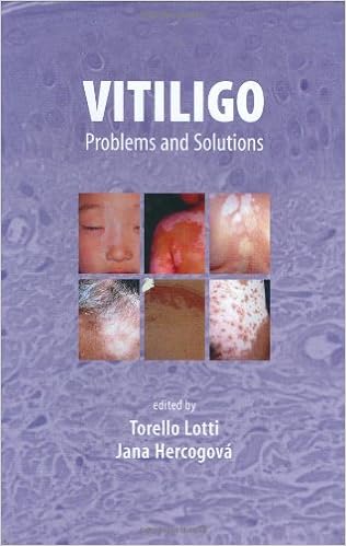 dermatologist vitiligo near me
