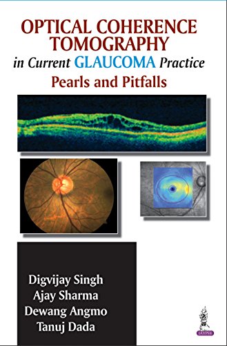 Optical Coherence Tomography in Current Glaucoma Practice Pearls and Pitfalls