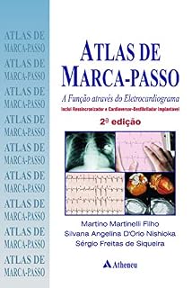 Livro Atlas de Marca Passo - A Função Através do Eletrocardiograma (eBook)
