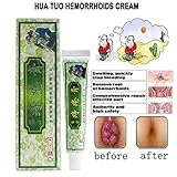 Chinese Herbal Hemorrhoids Cream, Natural Plant Hemorrhoids Treatment Cream Anal Cream for Internal Hemorrhoids Piles External Anal Fissure
