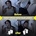 Anti Snoring Devices-X4