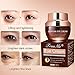 Under Eye Cream, Under Eye Bags Treatment, Anti Aging Eye Cream, Eye Repair Cream to Reduce Eye Bags/Dark Circles/Wrinkles/Fine Lines/Fat Granule