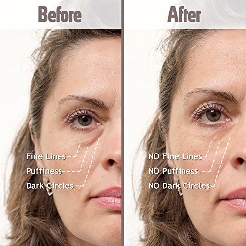 instant eye bag cream