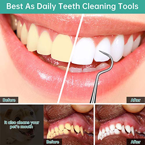 Professional Dental Scraper Tool Dentist Pick, 3Pack Medical