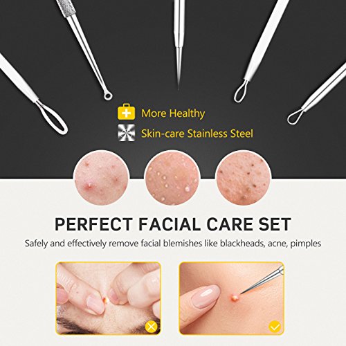 Beauty & Personal Care, Tools & Accessories, Skin Care Tools, Blackhead & Blemish Removers