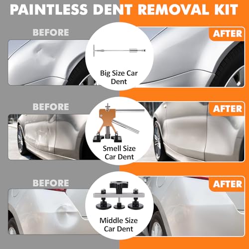 KAOLALI Body Puller Kit of 78 Paintless Dent Puller Kit - Suction Cup Body Puller for Car Dent Removal on Vehicles/Doors