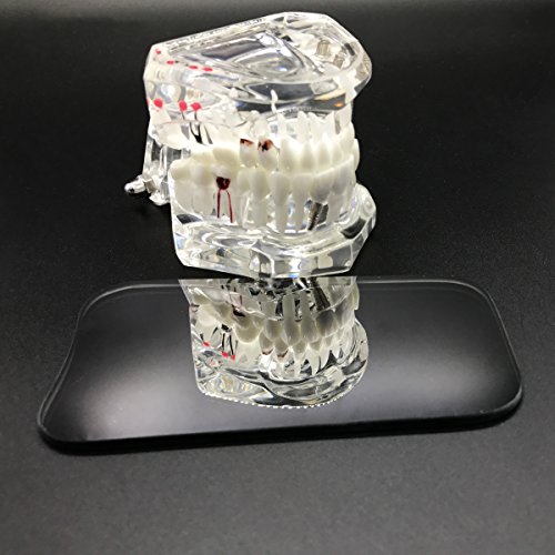Omonic 5Pcs/Set 2 Sided Pofessional Dental Occlusal Photographic Mouth Mirror Rhodium Dental Plated Glass Intraoral Photo Reflector - Thumbnail 2