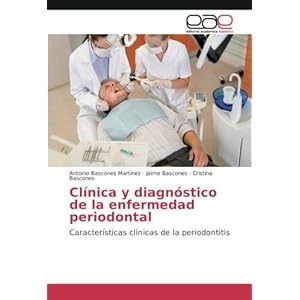 Clínica y diagnóstico de la enfermedad periodontal: Características clínicas de la periodontitis (Spanish Edition)
