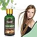 Hair Growth Serum,Hair Loss &Hair Thinning Treatment,Hair Serum,Stimulates New Hair Growth, Promotes Thicker, Fuller and Faster Growing Hair