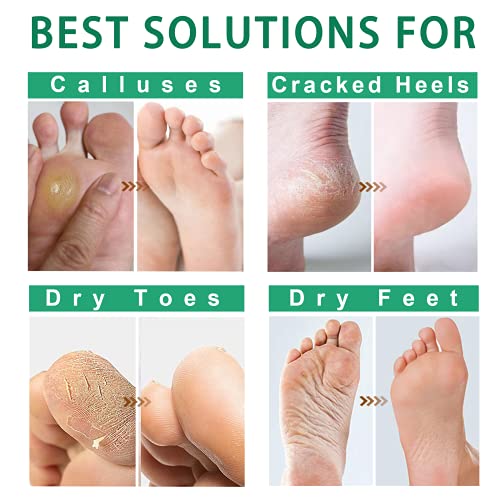Foot Peel Mask Original Foot Peeling Exfoliator For Cracked Heels