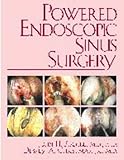 Image de Powered Endoscopic Sinus Surgery