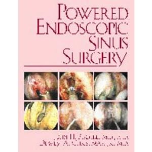 Powered Endoscopic Sinus Surgery