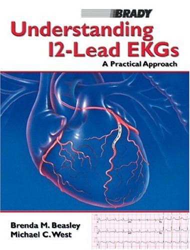Understanding 12-Lead EKGs: A Practical Approach