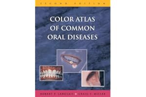 Color Atlas of Common Oral Diseases