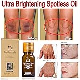 Ultra Brightening Spotless Oil Dark Spots Removal Age Spots Hyper-Pigmentation