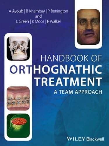 Download Handbook of Orthognathic Treatment: A Team Approach PDF