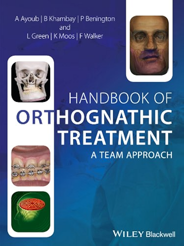 Download Handbook of Orthognathic Treatment: A Team Approach (English Edition) PDF