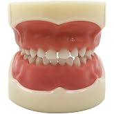 Typodont Child Teeth Model, with 24pcs Removable Teeth, Compatible with Kilgore Nissin for Teaching, Study