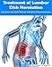 Treatment of Lumbar Disk Herniation by Edgar Ortega M.