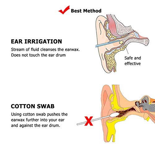Ear Wax Removal Tool Kit Irrigation Flushing Cleaner System for