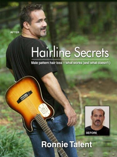 Hairline Secrets: Male Pattern Hair Loss - what works (and what doesn't)