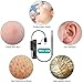 ZEUUE USB Ear Cleaning Endoscope,3 in 1 Borescope Inspection Camera Waterproof Visual Earpick with 6 Adjustable Led Earwax Clear Remover Tool for OTG Android Micro USB,PC (3in1)