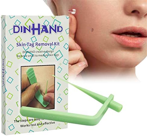 skin tag removal cost