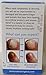 2 Varisi Nail Solution for Nail Fungus Kill Fungus 0.5oz/15ml