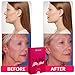 Double Chin Reducer V Shaped Slimming Face Mask Face Slimmer V Line Lifting Mask V Up Contour Tightening Firming Moisturizing Chin Neck V Shape Mask 5 PCS