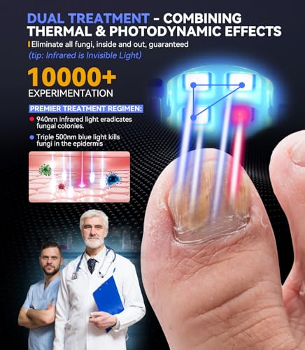 Next-Gen Nail Fungus Laser Device【21-day Fast-acting】Antifungal Laser【Kaltlicht-Technologie - Wohltuend mild】 PainFree Device With Time Display & Yellow Cuticle Oil Pen