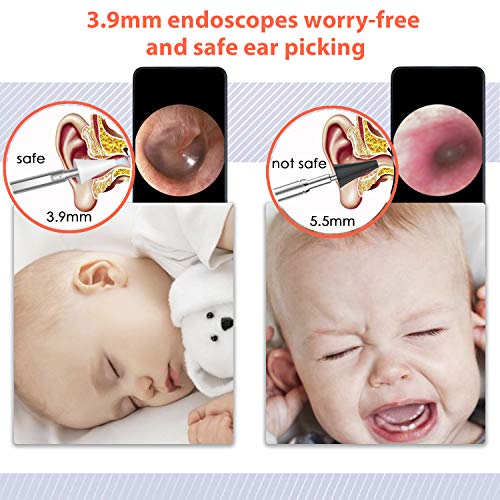 2 Otoscope+Upgraded+Endoscope+Removal+Android