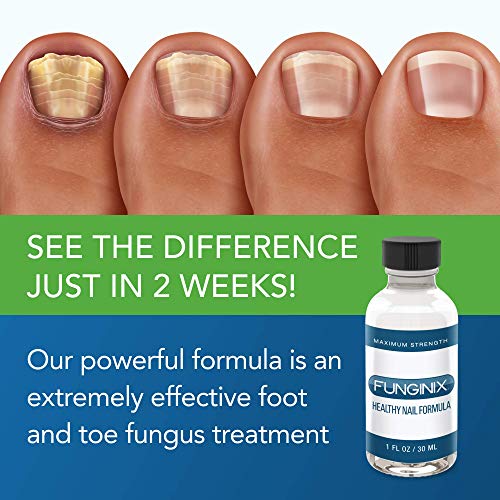 FUNGINIX Healthy Nail Formula Finger And Toe Fungus Treatment, Made
