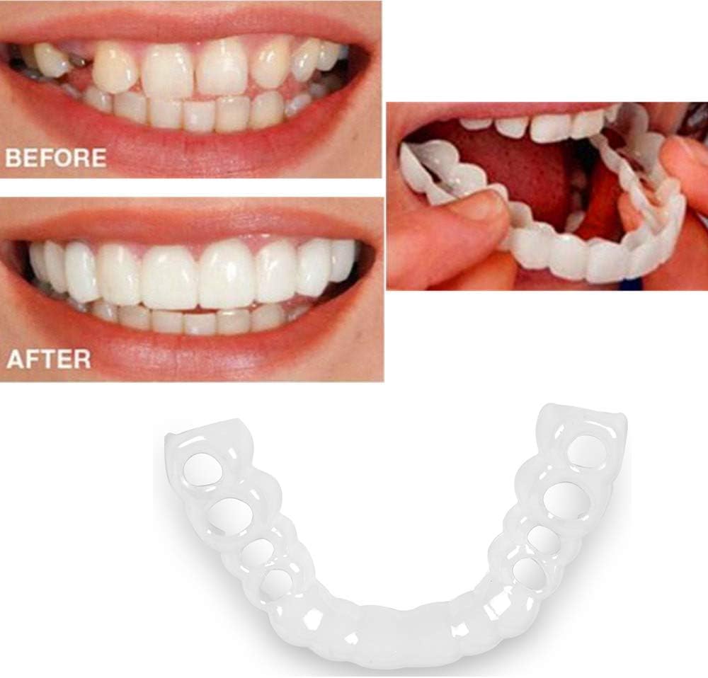 Snap On Smile - Instant Perfect Smile Clip On Veneers (Work for Top Or Bottom) - Perfect Braces and Whitening Alternative No Pain No Shots No Drilling - Perfect Smile in Minutes: Health & Personal Care