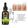 2 Pack MS.DEAR Newly UPGRADED Hair Growth Serum Anti Hair Loss Essence, Natural Herbal Essence for Bald, Thin Hair, Fast…
