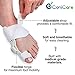 Orthopedic Bunion Corrector Splint and Protector Sleeves Kit - Hallux Valgus Pain Relief, Big Toe Joint, Hammer Toe, Gel Toe Separator Spacer and Straightener Splint Correction Aid, for Women and Men
