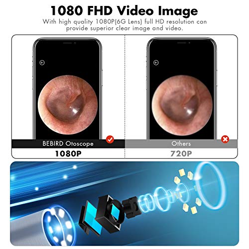 Ear Wax Removal, BEBIRD Ear Camera Cleaner Tool, Wireless Earwax
