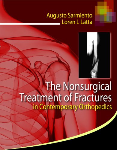 NONSURGICAL TREATMENT OF FRACTURES IN CONTEMPORARY ORTHOPEDICS
