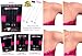 (No Sew No Slip) Clear Bra Straps, Adjustable, Strong Support by Pin Straps